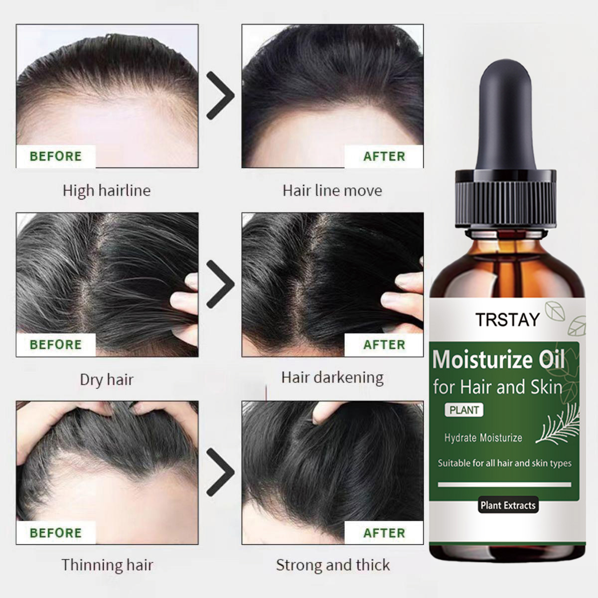 TRSTAY Rozemarijn etherische o - Rosemary Hair Oil recensie en prijs