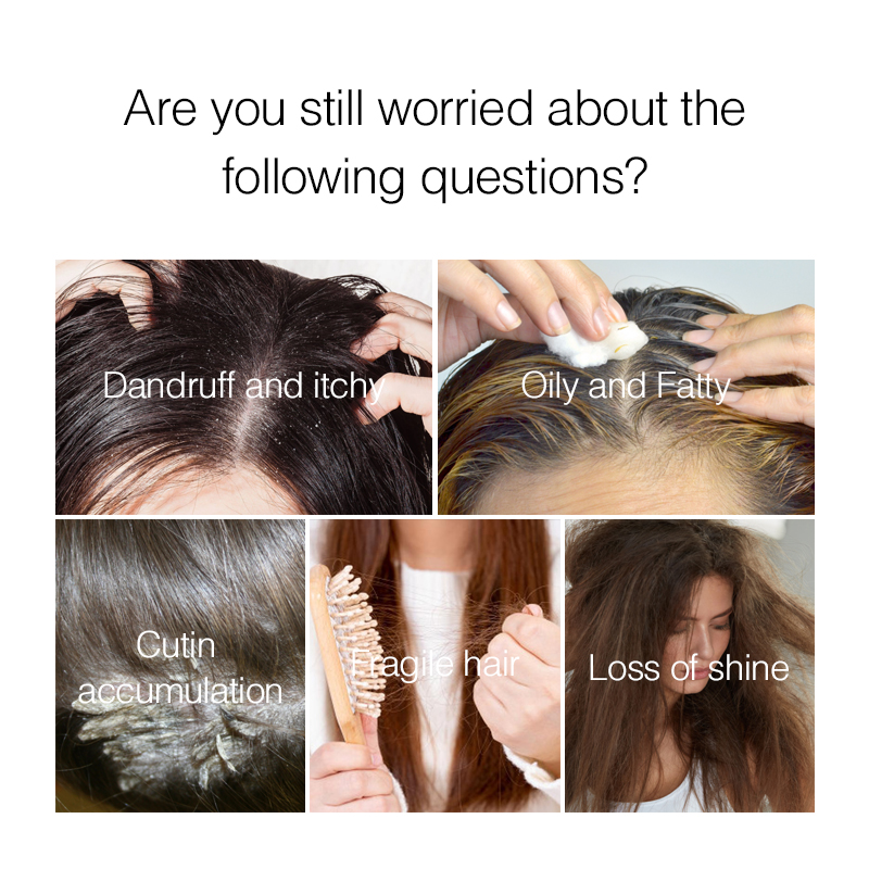 Purc Haar Hoofdhuid Behandelin - Hair Care Normal recensie en prijs