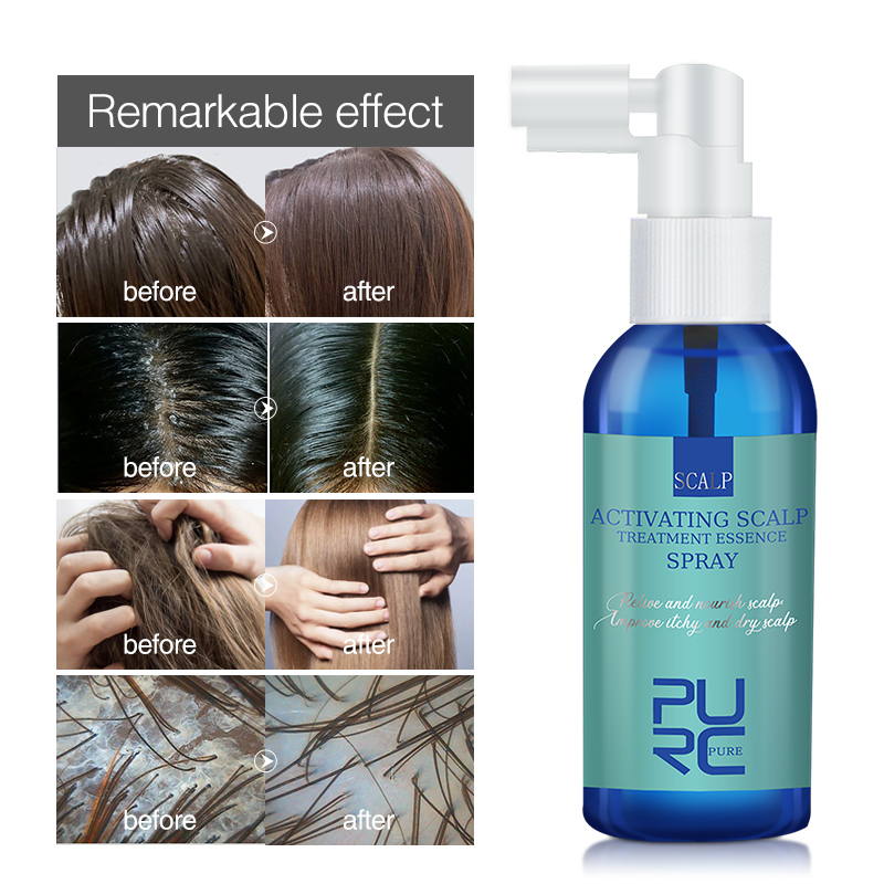 Purc Haar Hoofdhuid Behandelin - Hair Care Normal recensie en prijs